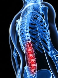 Spinal Cord Injuries